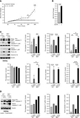 Metallothionein 3-Zinc Axis Suppresses Caspase-11 Inflammasome Activation and Impairs Antibacterial Immunity